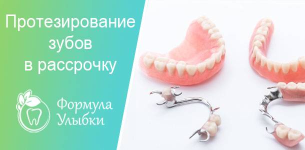 Где взять кредит на лечение зубов? как поставить зубы в рассрочку