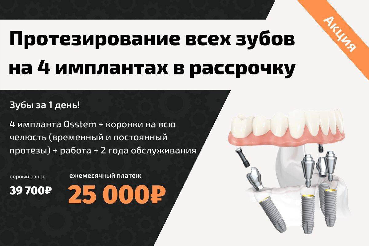 Где взять деньги на лечение зубов – 100% методы и способы достать деньги на зубы