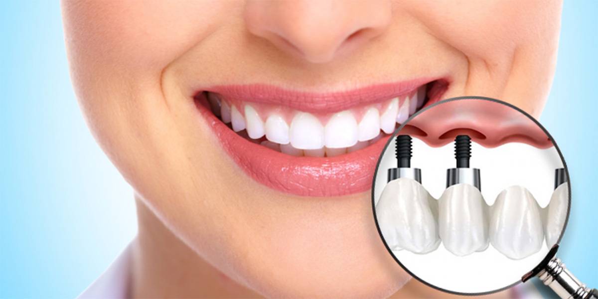 Взять кредит на лечение зубов: где и как лучше оформить