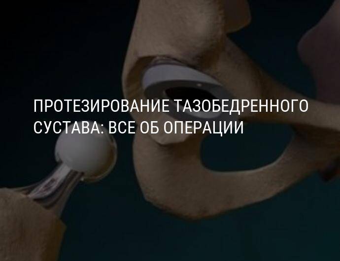 Квота на протезирование коленных суставов. Протезирование коленного сустава Операция по протезированию коленного сустава Протезирование с заменой коленного сустава в Германии — Цены на.